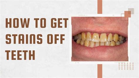 How to Get Tea Stains Off Teeth: A Comprehensive Guide to a Brighter Smile